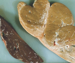 A healthy cross section of liver (left) compared to a liver affected by FE.